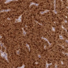 Immunohistochemical staining of human parathyroid gland shows strong positivity in glandular cells.