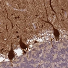Immunohistochemical staining of human cerebellum shows strong positivity in Purkinje cells.