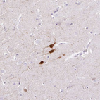 Immunohistochemical staining of human cerebral cortex shows strong positivity in a small subset of neurons.