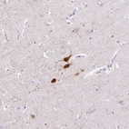 Immunohistochemical staining of human cerebral cortex shows strong positivity in a small subset of neurons.