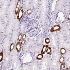 Immunohistochemical staining of human kidney shows strong positivity in cells in distal tubules.