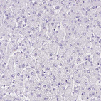 Immunohistochemical staining of human liver shows no positivity in hepatocytes as expected.