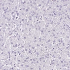 Immunohistochemical staining of human liver shows no positivity in hepatocytes as expected.