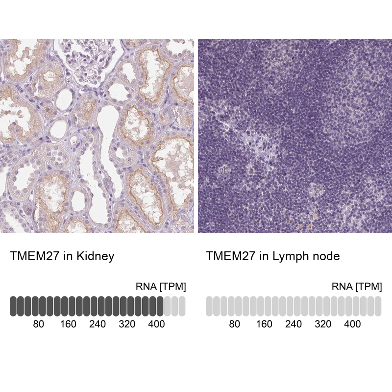 Anti-TMEM27 Antibody