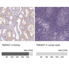 Anti-TMEM27 Antibody