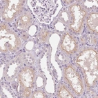 Immunohistochemical staining of human kidney shows high expression.