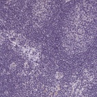 Anti-TMEM27 Antibody