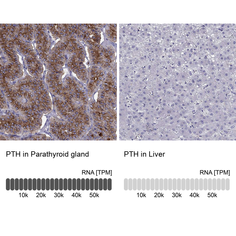 Anti-PTH Antibody