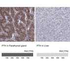 Anti-PTH Antibody