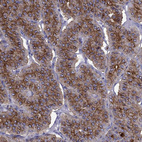 Immunohistochemical staining of human parathyroid gland shows moderate granular cytoplasmic and membranous positivity in glandular cells.