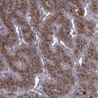 Immunohistochemical staining of human parathyroid gland shows moderate granular cytoplasmic and membranous positivity in glandular cells.