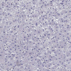 Immunohistochemical staining of human liver shows no positivity in hepatocytes as expected.
