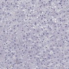 Immunohistochemical staining of human liver shows no positivity in hepatocytes as expected.