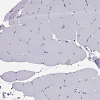 Immunohistochemical staining of human skeletal muscle shows no positivity in myocytes as expected.