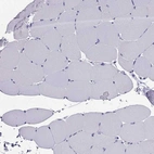 Immunohistochemical staining of human skeletal muscle shows no positivity in myocytes as expected.
