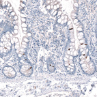 Immunohistochemical staining of human small intestine shows strong cytoplasmic positivity in neuroendocrine cells.