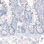 Immunohistochemical staining of human small intestine shows strong cytoplasmic positivity in neuroendocrine cells.