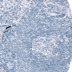 Immunohistochemical staining of human lymph node shows no positivity in lymphoid cells as expected.