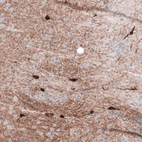Immunohistochemical staining of mouse basal forebrain shows strong cytoplasmic positivity in neuronal cells and fibers.