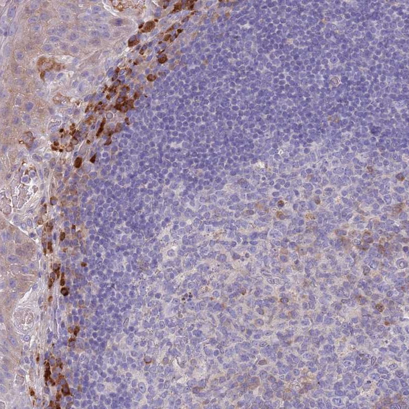 Anti-SUSD1 Antibody