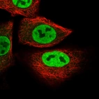 Immunofluorescent staining of human cell line A549 shows localization to nucleoplasm.