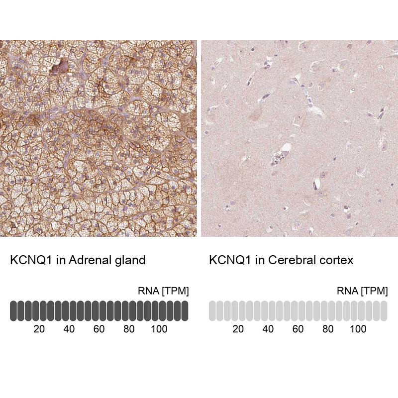 Anti-KCNQ1 Antibody