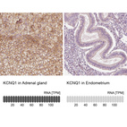 Anti-KCNQ1 Antibody