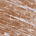 Immunohistochemical staining of human heart shows cytoplasmic positivity in cardiomyocytes.