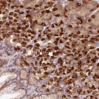 Immunohistochemical staining of human stomach shows cytoplasmic positivity in glandular cells.