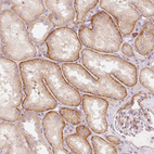 Immunohistochemical staining of human kidney shows membranous and cytoplasmic positivity in cells in tubules.