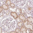 Immunohistochemical staining of human kidney shows cytoplasmic and membranous positivity in cells in tubules.