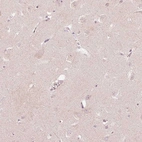 Immunohistochemical staining of human cerebral cortex shows no cytoplasmic positivity in neuronal cells as expected.