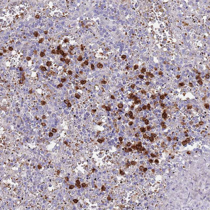 Anti-TMEM251 Antibody