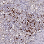 Anti-TMEM251 Antibody