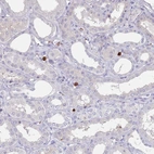 Immunohistochemical staining of human kidney shows moderate membranous and cytoplasmic positivity in leukocytes.