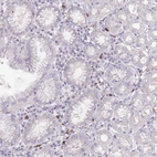Immunohistochemical staining of human stomach shows moderate membranous and cytoplasmic positivity in leukocytes.