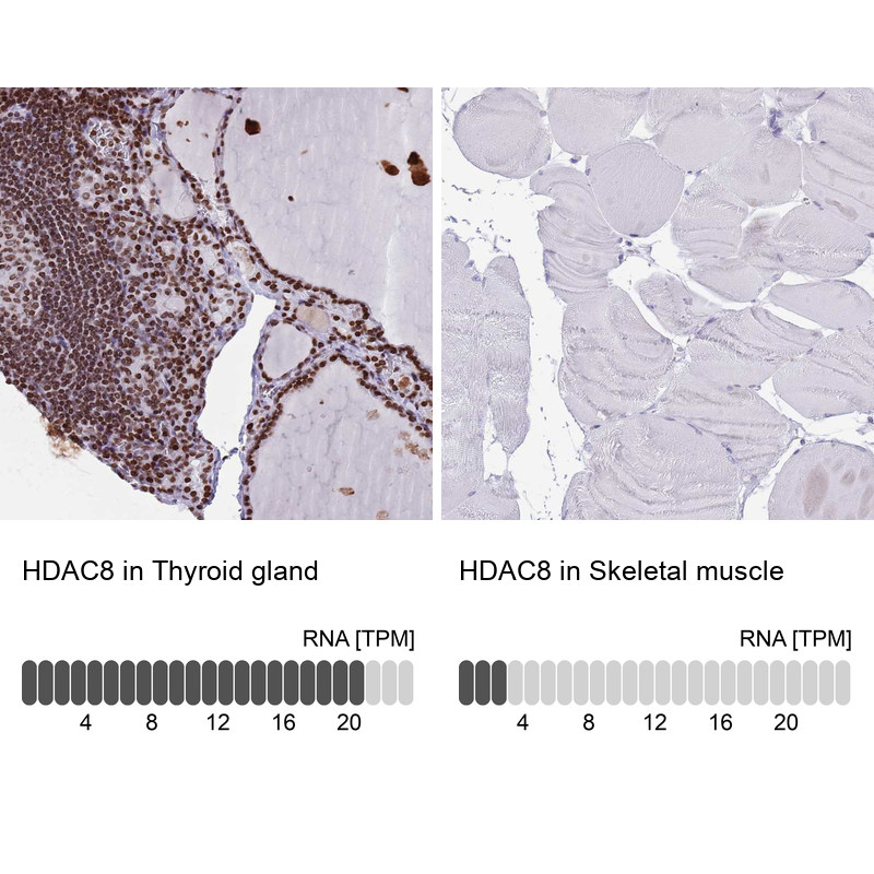 Anti-HDAC8 Antibody