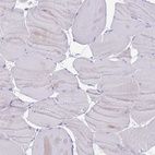 Immunohistochemical staining of human skeletal muscle shows no positivity in myocytes as expected.