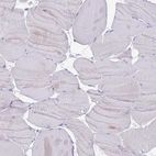 Immunohistochemical staining of human skeletal muscle shows no positivity in myocytes as expected.