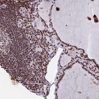 Immunohistochemical staining of human thyroid gland shows strong nuclear positivity in glandular cells.