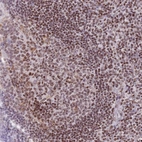 Immunohistochemical staining of human tonsil shows strong nuclear positivity in non-germinal and germinal center cells.