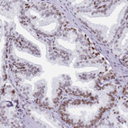 Anti-HDAC8 Antibody
