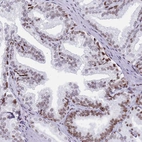 Immunohistochemical staining of human prostate shows moderate nuclear positivity in glandular cells.