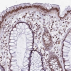 Immunohistochemical staining of human rectum shows moderate to strong nuclear positivity in glandular cells, as well as in lymphoid cells.