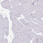 Immunohistochemical staining of human skeletal muscle shows no positivity in myocytes as expected.