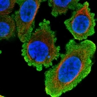 Immunofluorescent staining of human cell line PC-3 shows localization to nucleus & plasma membrane.