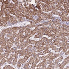 Anti-PCSK1 Antibody