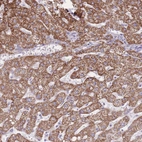 Anti-PCSK1 Antibody
