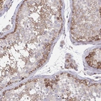 Anti-ASAP1 Antibody