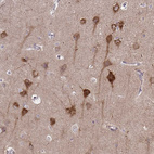 Immunohistochemical staining of human cerebral cortex shows strong cytoplasmic positivity in neurons.